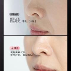 日本雅萌（YAMAN）美容仪脸部导入童颜机水光子嫩肤净颜导出家用精华M 10T Plus